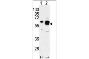 Western blot analysis of CK1G (arrow) using rabbit polyclonal CK1G Antibody (C-term) (R). (CAMK1G anticorps  (C-Term))
