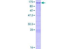 Image no. 1 for Recombination Activating Gene 1 (RAG1) (AA 1-931) protein (GST tag) (ABIN7595963)