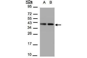 WB Image Sample(30 μg of whole cell lysate) A:A431, B:H1299 12% SDS PAGE antibody diluted at 1:1500 (TBCC anticorps)
