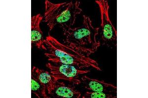 Immunofluorescence (IF) image for anti-T Antigen antibody (ABIN3001361) (T Antigen anticorps)
