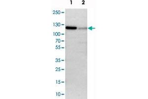 Western blot analysis of cell lysates with PAPOLA polyclonal antibody  at 1:250-1:500 dilution.