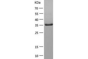 Western Blotting (WB) image for Protein tyrosine Phosphatase, Non-Receptor Type 7 (PTPN7) (AA 1-360) protein (His-IF2DI Tag) (ABIN7124682)