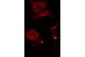 ABIN6277179 staining  Hela cells by IF/ICC. (DLGAP5 anticorps  (N-Term))