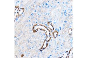 Immunohistochemistry of paraffin-embedded Mouse kidney using p38 MAPK Rabbit pAb (ABIN7268615) at dilution of 1:100 (40x lens).