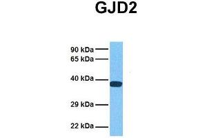 Host:  Rabbit  Target Name:  GJD2  Sample Tissue:  Human 293T  Antibody Dilution:  1. (GJD2 anticorps  (Middle Region))