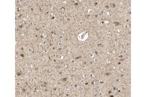 ABIN6266551 at 1/100 staining human brain tissue sections by IHC-P.