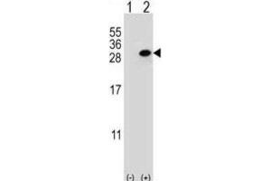 Western Blotting (WB) image for anti-Clathrin, Light Chain A (CLTA) antibody (ABIN3004002)