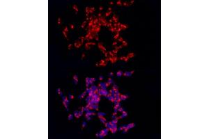Immunofluorescence analysis of SH-SY5Y cells using CART Rabbit pAb (ABIN6131305, ABIN6137949, ABIN6137950 and ABIN6221042) at dilution of 1:250 (40x lens).