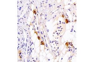 Immunohistochemistry of paraffin embedded rat thyroid gland using Calcitonin (ABIN7073271) at dilution of 1:700 (400x lens) (Calcitonin anticorps)