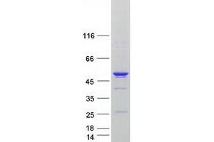 Validation with Western Blot