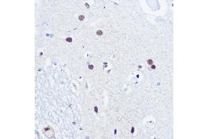 Immunohistochemistry of paraffin-embedded human brain using 53BP1 Rabbit pAb (ABIN6128833, ABIN6149414, ABIN6149415 and ABIN6221431) at dilution of 1:100 (40x lens).