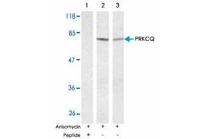 Western blot analysis of exreacts from HT-29 and K-562 cells untreated or treated with anisomycin (1mM, 30 min) using PRKCQ polyclonal antibody . (PKC theta anticorps)