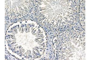 ABIN7095455 and ABIN7099512 at 1/100 staining rat testis tissue by IHC-P.