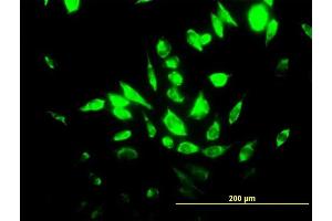 Immunofluorescence of purified MaxPab antibody to HMOX1 on HeLa cell.