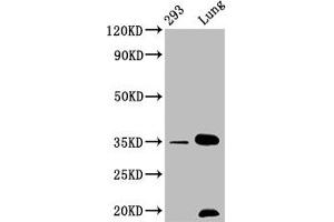 Western Blot Positive WB detected in: 293 whole cell lysate, Mouse lung tissue All lanes: CNN1 antibody at 1.