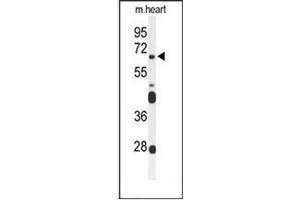 Western blot analysis of FZD4 Antibody (C-term) in mouse heart tissue lysates (35ug/lane).