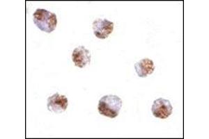 Immunocytochemistry of PAK6 in Raji cells with this product at 10 μg/ml.