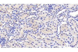 Detection of CEACAM1 in Human Kidney Tissue using Polyclonal Antibody to Carcinoembryonic Antigen Related Cell Adhesion Molecule 1 (CEACAM1)