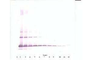 anti-Chemokine (C-C Motif) Ligand 2 (CCL2) antibody