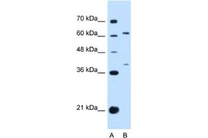 Western Blotting (WB) image for anti-Interleukin 28 Receptor, alpha (Interferon, lambda Receptor) (IL28RA) antibody (ABIN2463129) (IL28RA anticorps)