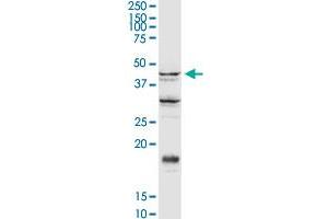 SGK2 MaxPab rabbit polyclonal antibody. (SGK2 anticorps  (AA 1-367))