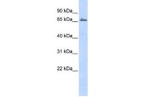 Human Placenta; WB Suggested Anti-ZNF503 Antibody Titration: 0. (ZNF503 anticorps  (Middle Region))