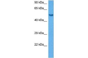 Host:  Rabbit  Target Name:  SP1  Sample Tissue:  Mouse Spleen  Antibody Dilution:  1ug/ml (SP1 anticorps  (Middle Region))