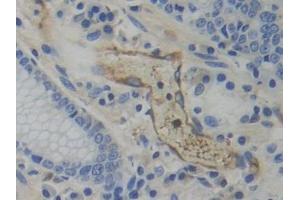 Detection of WARS in Human Stomach Tissue using Polyclonal Antibody to Tryptophanyl tRNA Synthetase (WARS)