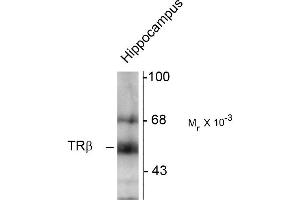 Western blots of hippocampal lysate showing specific immunolabeling of the ~58k TR-ß protein.