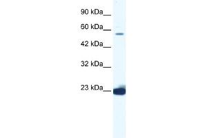 WB Suggested Anti-DDX55 Antibody Titration:  1.