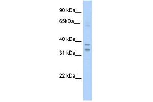 WB Suggested Anti-NR1I3 Antibody Titration:  5. (NR1I3 anticorps  (C-Term))
