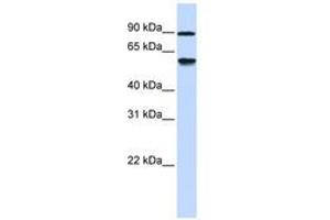 Image no. 1 for anti-Alcohol Dehydrogenase, Iron Containing, 1 (ADHFE1) (AA 288-337) antibody (ABIN6741163) (ADHFE1 anticorps  (AA 288-337))
