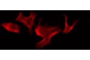 ABIN6276088 staining COLO205 by IF/ICC. (OR52B2 anticorps  (Internal Region))