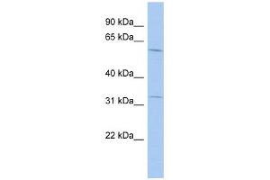 anti-FLJ20628 (N-Term) antibody