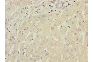 Immunohistochemistry of paraffin-embedded human liver tissue using ABIN7175794 at dilution of 1:100 (WDR74 anticorps  (AA 111-366))