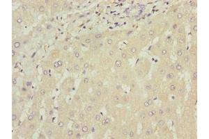 Immunohistochemistry of paraffin-embedded human liver tissue using ABIN7175794 at dilution of 1:100 (WDR74 anticorps  (AA 111-366))