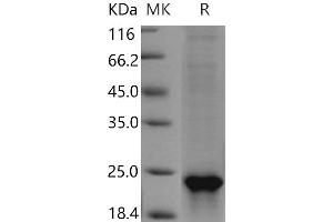 Sonic Hedgehog (SHH) (Active) protein (His tag)