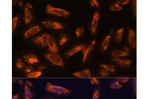 Immunofluorescence analysis of U-2 OS cells using CSF2 Polyclonal Antibody at dilution of 1:100. (GM-CSF anticorps)