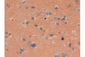 Detection of DDAH2 in Human Brain Tissue using Polyclonal Antibody to Dimethylarginine Dimethylaminohydrolase 2 (DDAH2)