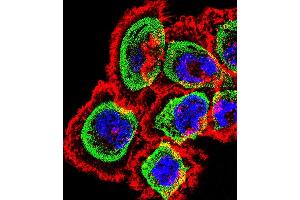 anti-Regulator of Calcineurin 1 (RCAN1) (AA 41-68), (N-Term) antibody