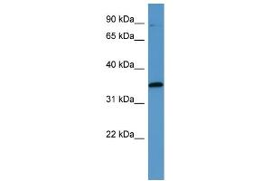 Western Blotting (WB) image for anti-Mitogen-Activated Protein Kinase-Activated Protein Kinase 3 (MAPKAPK3) (C-Term) antibody (ABIN2788403) (MAPKAP Kinase 3 anticorps  (C-Term))