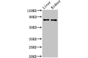 Western Blot Positive WB detected in: Mouse liver tissue, Mouse kidney tissue All lanes: SLC22A23 antibody at 5. (SLC22A23 anticorps  (AA 3-206))