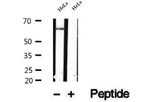 Western blot analysis of extracts of HeLa cells, using NFKBIZ antibody. (NFKBIZ anticorps  (Internal Region))