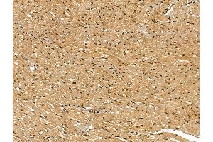 ABIN7094423 and ABIN7098470 at 1/100 staining Rat heart tissue by IHC-P.