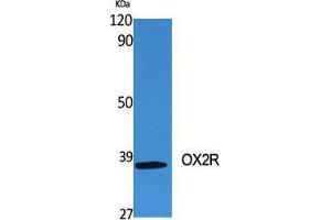 Western Blot (WB) analysis of specific cells using OX2R Polyclonal Antibody.