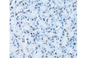 Immunohistochemistry of paraffin-embedded Rat pancreas using HNF4A Polyclonal Antibody at dilution of 1:100 (40x lens). (HNF4A anticorps)