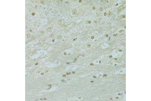 Immunohistochemistry of paraffin-embedded mouse brain using RCC1 antibody (ABIN5973761) at dilution of 1/100 (40x lens). (RCC1 anticorps)