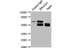 Immunoprecipitating DNAJA3 in Hela whole cell lysate Lane 1: Rabbit control IgG instead of ABIN7150498 in Hela whole cell lysate. (DNAJA3 anticorps  (AA 86-184))