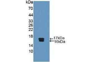 Detection of Recombinant Glycocalicin, Human using Polyclonal Antibody to Glycocalicin (GC) (Glycocalicin anticorps  (AA 136-276))