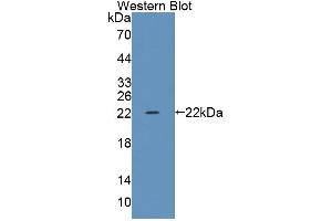 Western blot analysis of the recombinant protein. (TRERF1 anticorps  (AA 785-942))